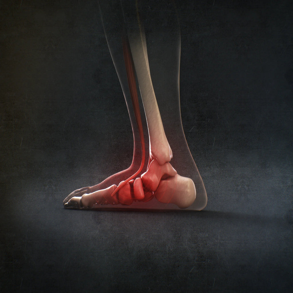 How to get rid of plantar fasciitis?